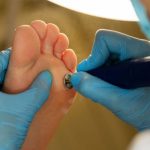 Tus Pies Merecen Atención Especializada: Descubre la Podología en Centro Médico Risco